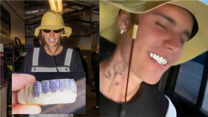 Justin Bieber Fits New Custom Diamond Grillz-1